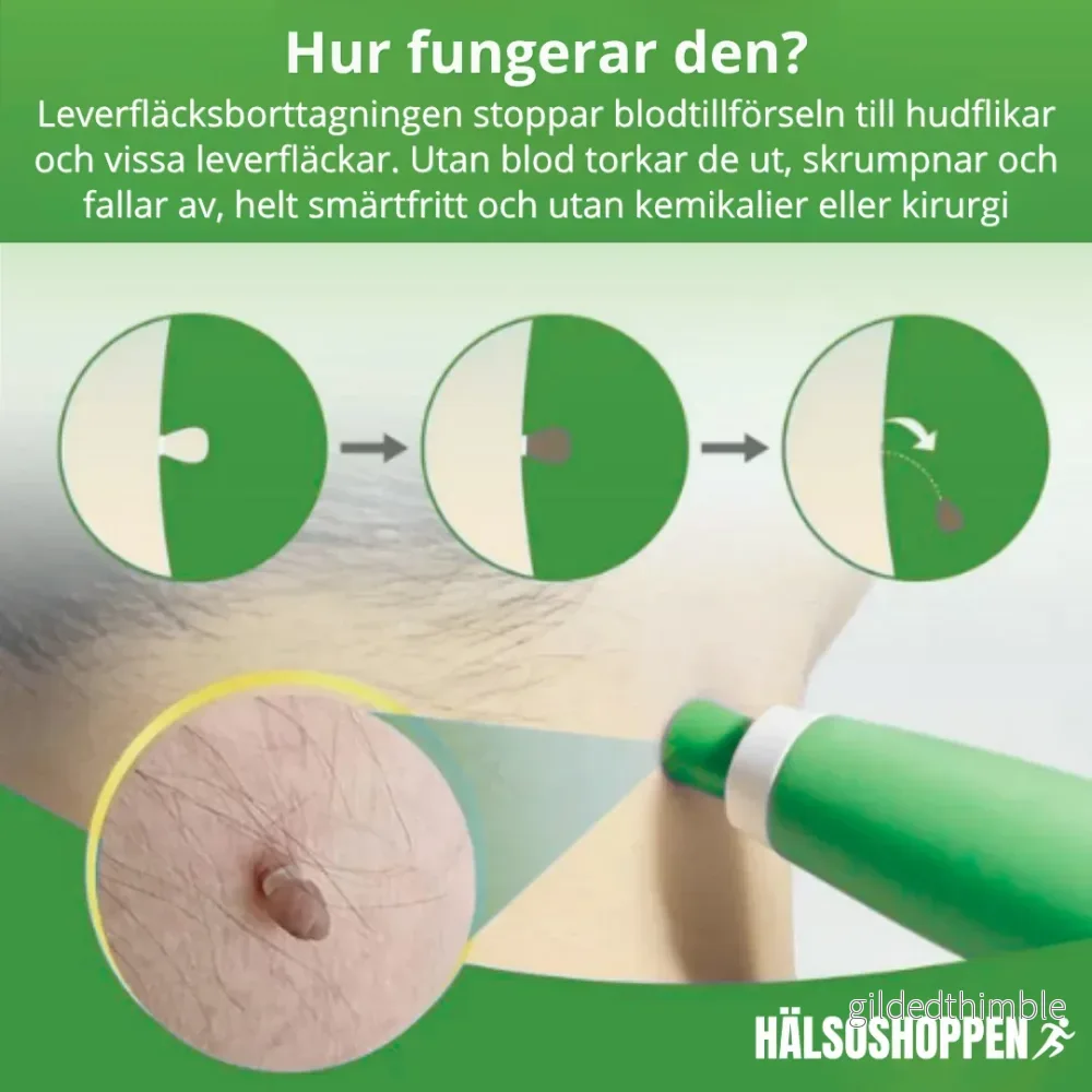 Hudflikskit – Hemmabruk - Bild 2